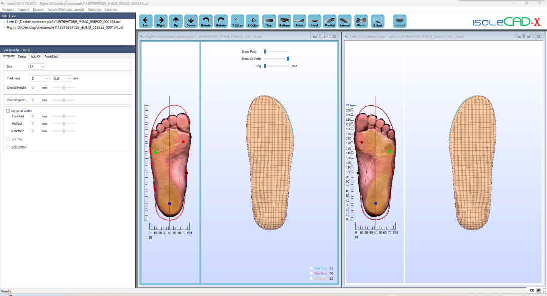 3D Custom Insole CAD Software