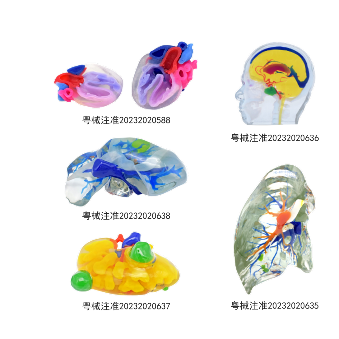 Full-Color 3D Printed Surgical Planning Model