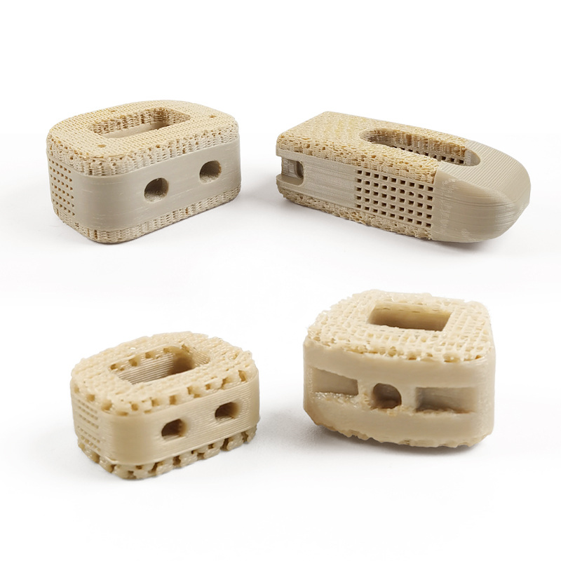 Interbody Fusion Cage